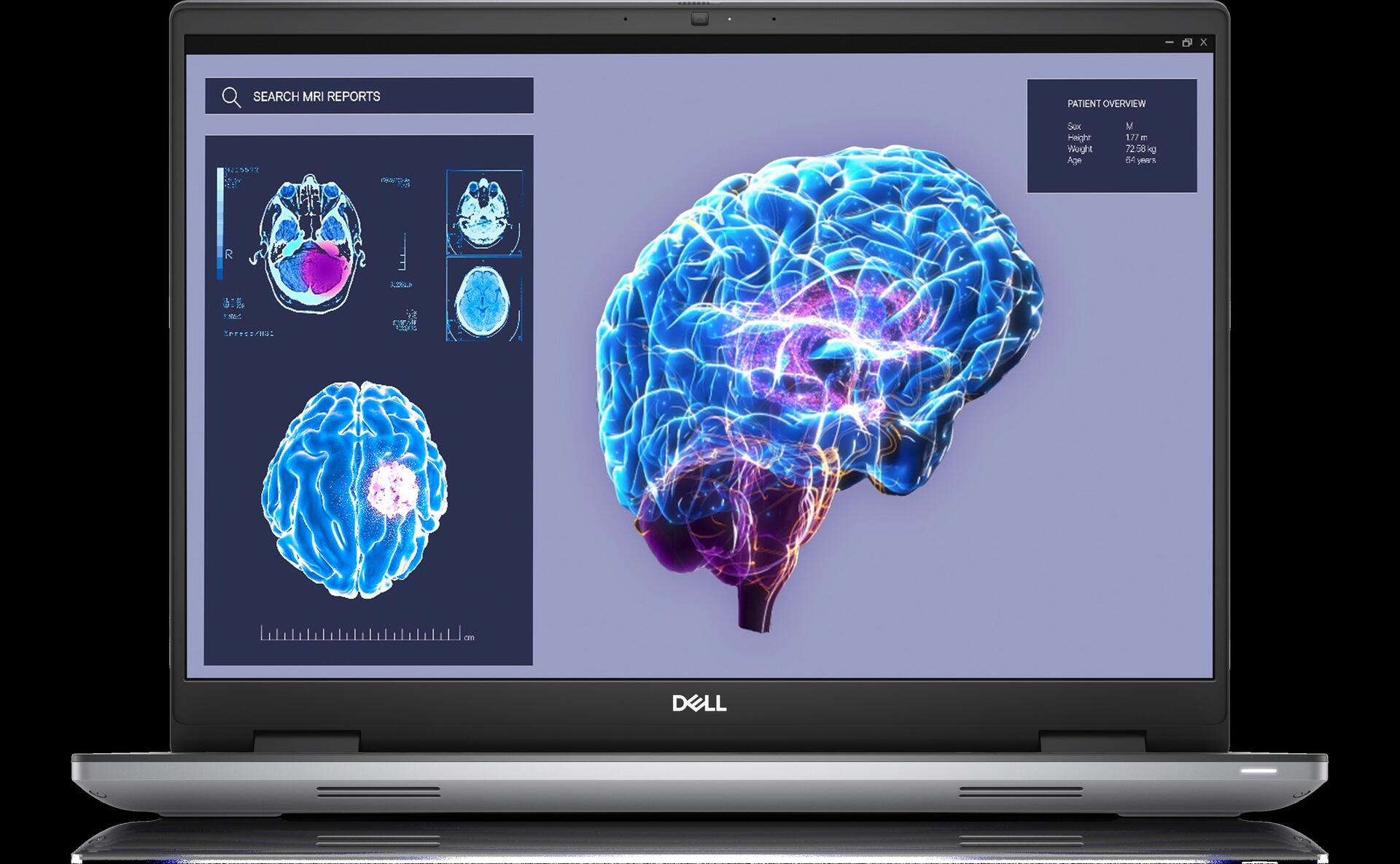 Купить Dell Precision 7680 - Intel Core i9 13950HX / 2.2 GHz - Win 11 Pro - NVIDIA RTX 3500 Ada - 32 GB RAM - 1 TB SSD NVMe, Class 40 - 40.64 cm (16") 1920 x 1200 (Full HD Plus) - 802.11a/b/g/n/ac/ax (Wi-Fi 6E), Bluetooth - Gra (MVHK0) в магазине wardena.ru