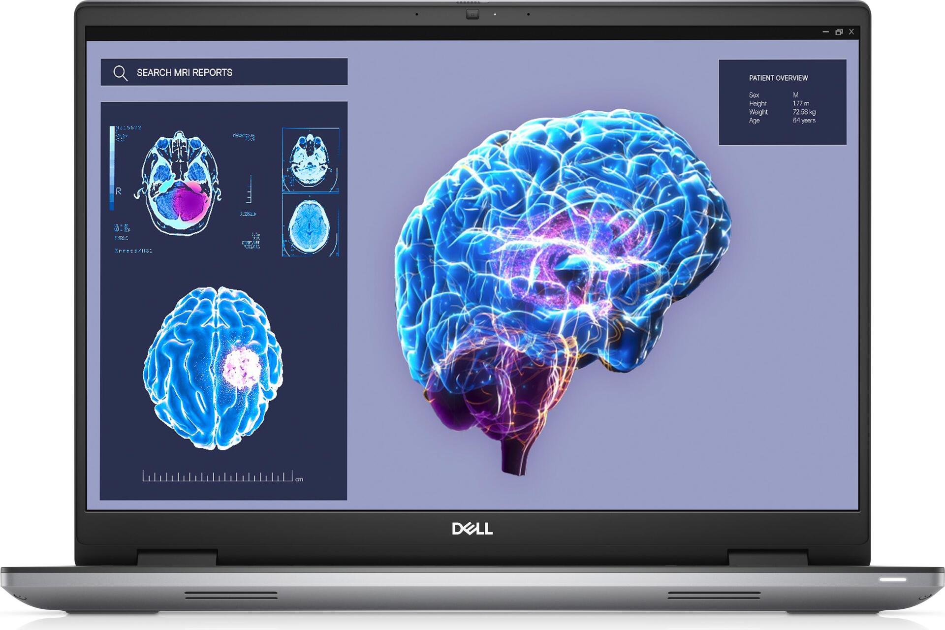 Купить Dell Precision 7680 - Intel Core i9 13950HX / 2.2 GHz - Win 11 Pro - NVIDIA RTX 3500 Ada - 32 GB RAM - 1 TB SSD NVMe, Class 40 - 40.64 cm (16") 1920 x 1200 (Full HD Plus) - 802.11a/b/g/n/ac/ax (Wi-Fi 6E), Bluetooth - Gra (MVHK0) в магазине wardena.ru